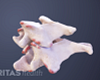 Two cervical vertebrae with bone spurs