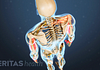 Posterior view of the skeleton showing pain in the body.