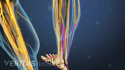 Medical illustration of the lower legs showing bone and nerve structures. One nerve in the right leg is highlighted in red to indicate pain, numbness or tingling.