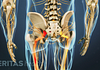 Posterior view of the pelvis showing pain radiating down the left leg.